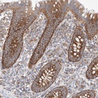 Anti-KTI12 Antibody