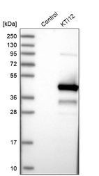 Anti-KTI12 Antibody