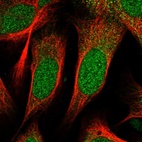 Anti-ZNF518B Antibody