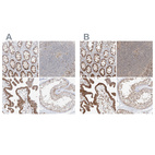 Anti-BYSL Antibody