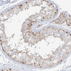 Anti-BYSL Antibody