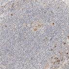 Anti-BYSL Antibody