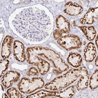 Anti-PKHD1 Antibody