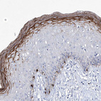 Anti-KLHL17 Antibody