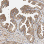 Anti-CPAMD8 Antibody