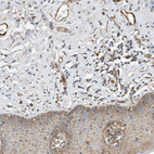 Anti-CPAMD8 Antibody