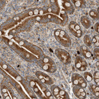 Anti-CPAMD8 Antibody