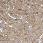 Anti-GTPBP2 Antibody