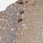 Immunohistochemical staining of human cerebellum shows strong cytoplasmic positivity in purkinje cells.