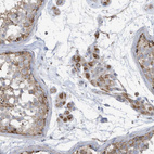 Immunohistochemical staining of human testis shows moderate cytoplasmic positivity in cells in seminiferous ducts.