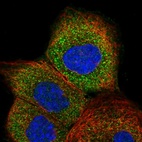 Immunofluorescent staining of human cell line A-431 shows localization to vesicles.