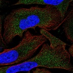 Anti-MOV10 Antibody