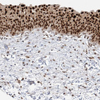 Immunohistochemical staining of human urinary bladder shows strong nuclear positivity in urothelial cells.