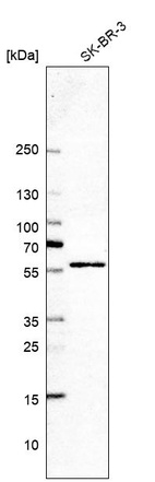 Anti-GHDC Antibody