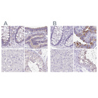 Anti-ANKRD45 Antibody