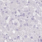 Anti-ANKRD45 Antibody