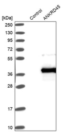 Anti-ANKRD45 Antibody