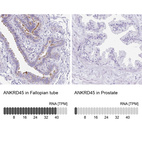 Anti-ANKRD45 Antibody