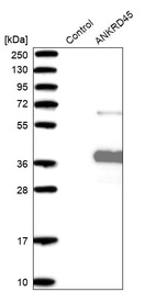 Anti-ANKRD45 Antibody