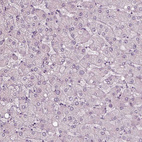 Anti-RSPH9 Antibody