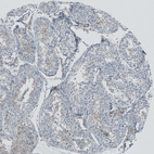 Anti-RSPH9 Antibody