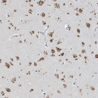 Anti-GPR107 Antibody