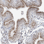 Anti-GPR107 Antibody