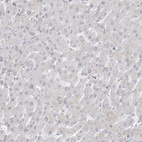 Anti-GPR107 Antibody