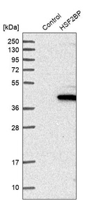 Anti-HSF2BP Antibody