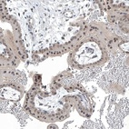 Anti-TAF8 Antibody