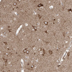 Anti-COLGALT2 Antibody