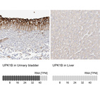 Anti-UPK1B Antibody