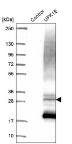 Anti-UPK1B Antibody