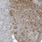 Anti-PARVG Antibody