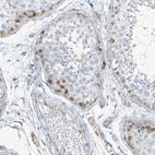 Anti-HIC2 Antibody