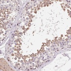 Immunohistochemical staining of human testis shows high expression.