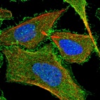 Immunofluorescent staining of human cell line U-2 OS shows localization to plasma membrane.