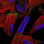 Anti-OSBPL6 Antibody