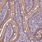 Anti-C6orf106 Antibody