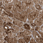 Anti-MAPK1IP1L Antibody