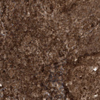 Anti-MAPK1IP1L Antibody