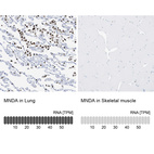 Anti-MNDA Antibody