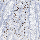 Anti-MNDA Antibody