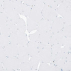 Anti-MNDA Antibody