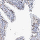 Anti-MAN1A2 Antibody