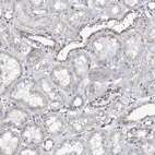 Anti-MAN1A2 Antibody