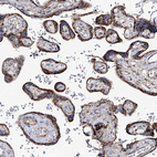 Anti-MAN1A2 Antibody