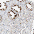 Anti-SLC35F6 Antibody