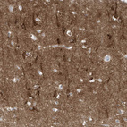 Anti-C11orf87 Antibody