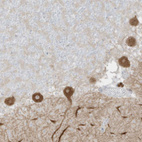 Immunohistochemical staining of human cerebellum shows strong cytoplasmic positivity in Purkinje cells.